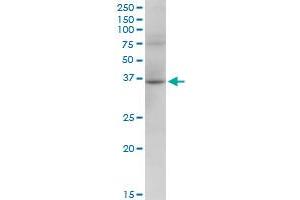 RHOXF2 MaxPab polyclonal antibody. (RHOXF2 抗体  (AA 1-288))