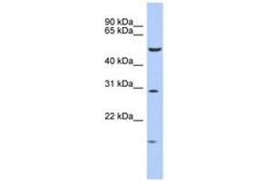 Image no. 1 for anti-Homeobox C5 (HOXC5) (AA 143-192) antibody (ABIN6742202) (Homeobox C5 抗体  (AA 143-192))