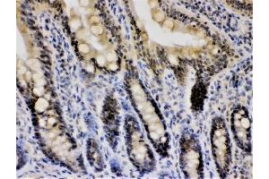 IHC analysis of CRY1 using anti-CRY1 antibody (ABIN3042761).