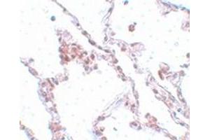 Immunohistochemical staining of human lung tissue with TMEM184B polyclonal antibody  at 5 ug/mL dilution.