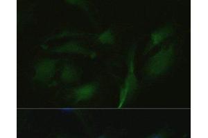 Immunofluorescence (IF) image for anti-Transient Receptor Potential Cation Channel, Subfamily V, Member 1 (TRPV1) antibody (ABIN7264613)