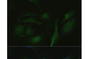Immunofluorescence analysis of U2OS cells using TRPV1 Polyclonal Antibody at dilution of 1:100. (TRPV1 抗体)