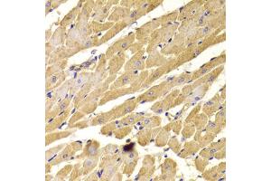 Immunohistochemistry of paraffin-embedded rat heart using PEX5 antibody (ABIN5973402) at dilution of 1/100 (40x lens). (PEX5 抗体)