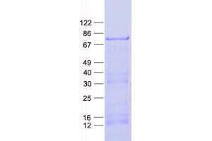 Western Blotting (WB) image for CAP-GLY Domain Containing Linker Protein Family, Member 4 (CLIP4) protein (His tag) (ABIN2712881)