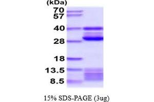 SDS-PAGE (SDS) image for Cathepsin S (CTSS) (AA 21-340) protein (His tag) (ABIN5854578) (Cathepsin S Protein (CTSS) (AA 21-340) (His tag))