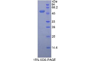SDS-PAGE (SDS) image for Peroxiredoxin 3 (PRDX3) (AA 64-257) protein (His tag,GST tag) (ABIN1878223) (Peroxiredoxin 3 Protein (PRDX3) (AA 64-257) (His tag,GST tag))
