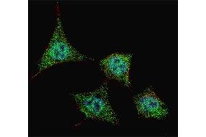 Fluorescent confocal image of HeLa cells stained with phospho-Bad antibody at 1:200.