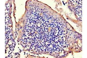 Immunohistochemistry of paraffin-embedded human tonsil tissue using ABIN7150275 at dilution of 1:100 (RAD54B 抗体  (AA 1-167))