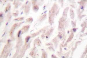 AP20222PU-N Dematin antibody staining of Paraffin-Embedded Human heart tissue by Immunohistochemistry.