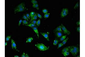 Immunofluorescent analysis of HepG2 cells using ABIN7158563 at dilution of 1:100 and Alexa Fluor 488-congugated AffiniPure Goat Anti-Rabbit IgG(H+L) (LDLR 抗体  (AA 49-244))