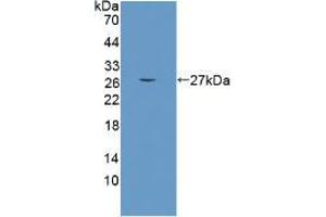 Western blot analysis of the recombinant protein. (CRAT 抗体  (AA 55-256))