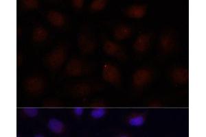 Immunofluorescence analysis of HeLa cells using ACADSB Polyclonal Antibody at dilution of 1:100 (40x lens). (ACADSB 抗体)