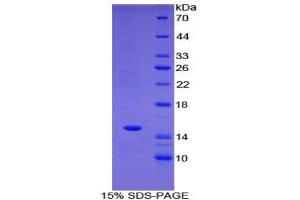 SDS-PAGE (SDS) image for T-Box 3 (TBX3) (AA 107-220) protein (His tag) (ABIN1877854)