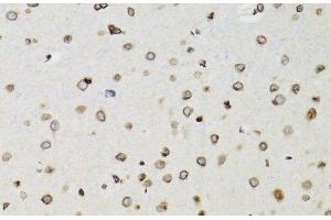 Immunohistochemistry of paraffin-embedded Rat brain using TMPO Polyclonal Antibody at dilution of 1:100 (40x lens). (Thymopoietin 抗体)
