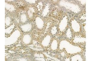ABIN6265206 and ABIN6273074 at 1/100 staining human normal kidney tissue by IHC-P. (SNAPIN 抗体  (N-Term))