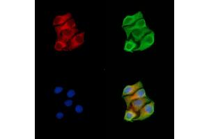 ABIN7094876 and ABIN7098928 staining Hela cells by IF/ICC.
