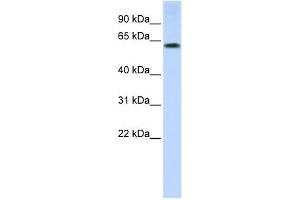 TRIM55 antibody used at 1 ug/ml to detect target protein. (TRIM55 抗体  (N-Term))