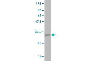 Western Blot detection against Immunogen (37. (CD42b 抗体  (AA 19-128))