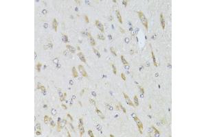 Immunohistochemistry of paraffin-embedded mouse brain using RPL13 Antibody (ABIN2559760) at dilution of 1:100 (40x lens). (RPL13 抗体)