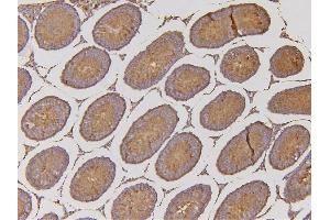 IHC analysis of EHD1 using anti-EHD1 antibody (ABIN6719599).