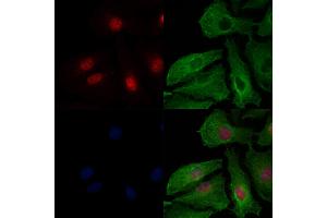 anti-Nuclear Factor of Activated T-Cells 5, Tonicity-Responsive (NFAT5) antibody