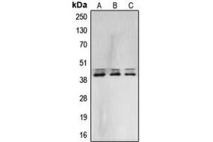 Western blot analysis of ERK1/2 expression in A431 (A), NIH3T3 (B), PC12 (C) whole cell lysates. (ERK1/2 抗体  (Center))