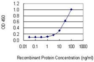 Detection limit for recombinant GST tagged PDLIM1 is 1 ng/ml as a capture antibody. (PDLIM1 抗体  (AA 123-232))