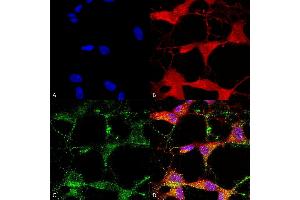 Immunocytochemistry (ICC) image for anti-Transient Receptor Potential Cation Channel, Subfamily V, Member 3 (TRPV3) (AA 458-474) antibody (ABIN863127)