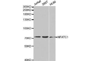 Western blot analysis of extracts of various cell lines, using NFATC1 antibody. (NFATC1 抗体  (AA 20-300))