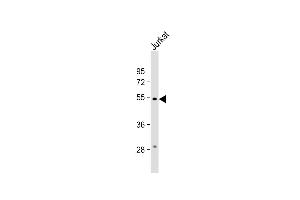 Anti-C13orf18 Antibody (Center) at 1:1000 dilution + Jurkat whole cell lysate Lysates/proteins at 20 μg per lane. (C13orf18 抗体  (AA 379-405))