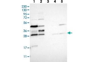 Western blot analysis of Lane 1: RT-4, Lane 2: U-251 MG, Lane 3: Human Plasma, Lane 4: Liver, Lane 5: Tonsil with RRP15 polyclonal antibody  at 1:250-1:500 dilution. (RRP15 抗体)
