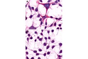 Immunocytochemistry (ICC) staining of HEK293 human embryonic kidney cells transfected (A) or untransfected (B) with GRM3. (Metabotropic Glutamate Receptor 3 抗体  (Extracellular Domain))