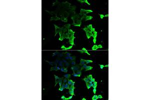Immunofluorescence analysis of HeLa cell using TANK antibody. (TANK 抗体)