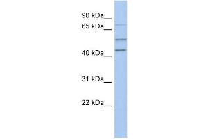 WB Suggested Anti-NEDD1 Antibody Titration: 0. (NEDD1 抗体  (N-Term))