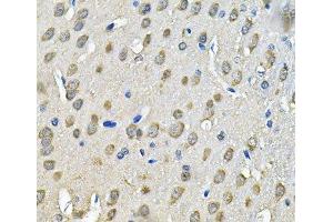 Immunohistochemistry of paraffin-embedded Rat brain using PRKAB2 Polyclonal Antibody at dilution of 1:100 (40x lens). (PRKAB2 抗体)