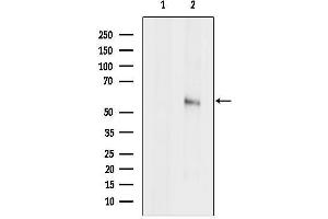 Western blot analysis of lysates from HepG2 cells, using SPTLC1 Antibody.