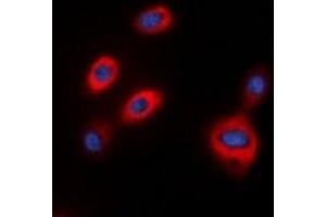 Immunofluorescent analysis of TPH1 staining in HepG2 cells. (Tryptophan Hydroxylase 1 抗体  (N-Term))
