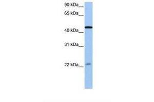 Image no. 1 for anti-Ewing Sarcoma Breakpoint Region 1 (EWSR1) (AA 173-222) antibody (ABIN6737947) (EWSR1 抗体  (AA 173-222))