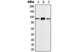 Western blot analysis of PLA2G4A expression in HeLa (A), THP1 (B), NIH3T3 (C) whole cell lysates. (PLA2G4A 抗体  (Center))
