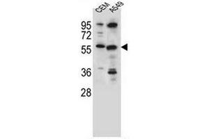 CSAD Antibody (Center) western blot analysis in CEM,A549 cell line lysates (35µg/lane).