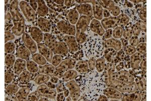 ABIN6277109 at 1/100 staining Rat kidney tissue by IHC-P. (TNFAIP3 抗体  (Internal Region))