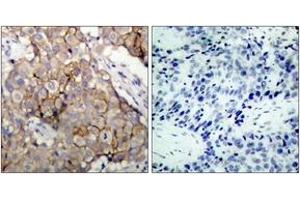 Immunohistochemistry (IHC) image for anti-Epidermal Growth Factor Receptor (EGFR) (AA 1061-1110) antibody (ABIN2888974) (EGFR 抗体  (AA 1061-1110))