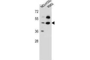 Western Blotting (WB) image for anti-Leprecan-Like 4 (LEPREL4) antibody (ABIN5016836) (Leprecan-Like 4 抗体)