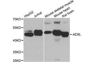 Western blot analysis of extracts of various cell lines, using ADSL antibody. (Adenylosuccinate Lyase 抗体  (AA 1-310))