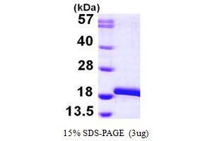SDS-PAGE (SDS) image for Microtubule-Associated Protein 1 Light Chain 3 beta (MAP1LC3B) (AA 1-120) protein (His tag) (ABIN667327) (LC3B Protein (AA 1-120) (His tag))