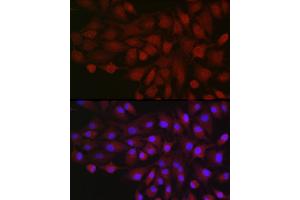 Immunofluorescence analysis of  cells using BDKRB1 Rabbit pAb (ABIN7265910) at dilution of 1:250 (40x lens). (BDKRB1 抗体  (AA 1-100))