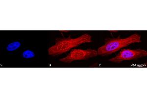 Immunocytochemistry/Immunofluorescence analysis using Rabbit Anti-Alpha B Crystallin Polyclonal Antibody . (CRYAB 抗体  (Atto 390))