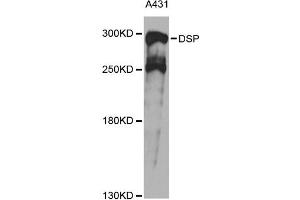 Western blot analysis of extracts of A431 cells, using DSP antibody.