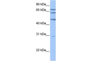 Western Blotting (WB) image for anti-Testis-Specific serine Kinase Substrate (TSKS) antibody (ABIN2463604) (TSKS 抗体)