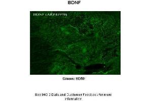 Immunohistochemistry (IHC) image for anti-Brain-Derived Neurotrophic Factor (BDNF) (Middle Region) antibody (ABIN2777093) (BDNF 抗体  (Middle Region))